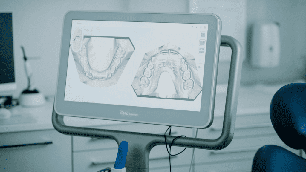 iTero scaner - stomatologia cyfrowa w Astermed
